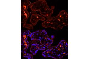 Immunofluorescence (IF) image for anti-Cytochrome P450, Family 11, Subfamily A, Polypeptide 1 (CYP11A1) (AA 40-320) antibody (ABIN1512804)