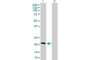 Western Blot analysis of MCAT expression in transfected 293T cell line by MCAT MaxPab polyclonal antibody. (MCAT 抗体  (AA 1-180))