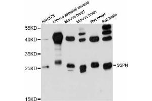 Western blot analysis of extracts of various cell lines, using SSPN antibody (ABIN6293742) at 1:3000 dilution. (SSPN 抗体)