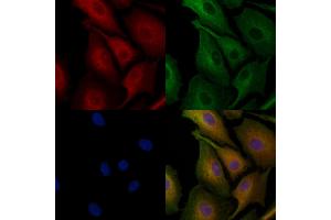 ABIN6259672 and ABIN6278181 staining  cells by IF/ICC.