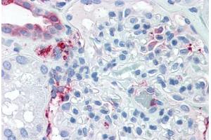 Anti-SLC39A14 antibody  ABIN1049336 IHC staining of human kidney. (SLC39A14 抗体  (Internal Region))