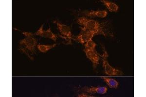 Immunofluorescence analysis of C6 cells using PYCR2 Polyclonal Antibody at dilution of 1:100. (PYCR2 抗体)
