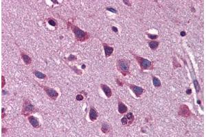 Human Brain, Cortex: Formalin-Fixed, Paraffin-Embedded (FFPE) (ZEB2 抗体  (AA 30-79))