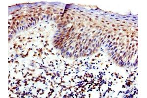 IHC image of ABIN7175826 diluted at 1:400 and staining in paraffin-embedded human tonsil tissue performed on a Leica BondTM system. (WASP 抗体  (AA 145-265))