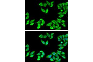 Immunofluorescence analysis of MCF-7 cells using RPS14 antibody. (RPS14 抗体)