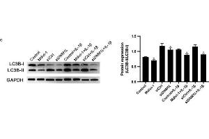 DNM1L deficiency reduces ROS production and autophagy in FLS. (GAPDH 抗体)
