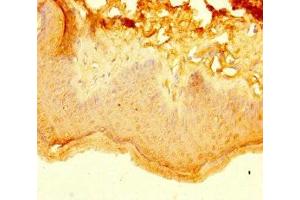 Immunohistochemistry of paraffin-embedded human skin tissue using ABIN7157404 at dilution of 1:100 (KRT4 抗体  (AA 1-200))