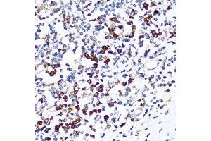 Immunohistochemistry of paraffin-embedded human tonsil using RPN1 antibody. (RPN1 抗体  (AA 20-280))