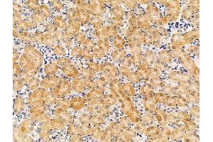ABIN7094609 and ABIN7098659 at 1/100 staining Mouse kidney tissue by IHC-P. (PDE11A 抗体  (Internal Region))