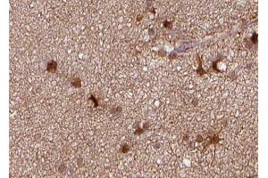 Immunohistochemistry (IHC) image for anti-Tumor Necrosis Factor Receptor Superfamily, Member 6b, Decoy (TNFRSF6B) antibody (ABIN6265644)