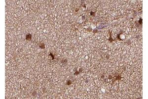 ABIN6266780 at 1/100 staining human brain tissue sections by IHC-P.
