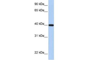 WB Suggested Anti-RDH11 Antibody Titration:  0. (RDH11 抗体  (C-Term))