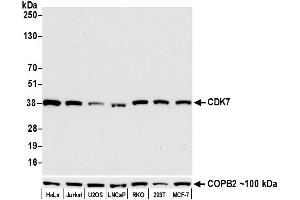 Western Blotting (WB) image for anti-Cyclin-Dependent Kinase 7 (CDK7) (AA 300-346) antibody (ABIN7454008)