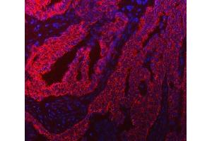 anti-Trk-Fused Gene (TFG) (AA 121-400) antibody