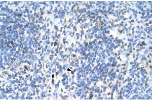 Immunohistochemistry (IHC) image for anti-Proliferating Cell Nuclear Antigen (PCNA) (C-Term) antibody (ABIN2792157)