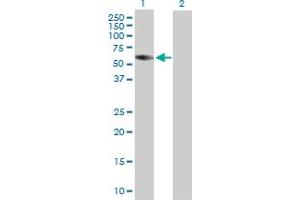 Western Blot analysis of CORO2B expression in transfected 293T cell line by CORO2B MaxPab polyclonal antibody. (CORO2B 抗体  (AA 1-475))