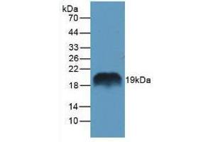 Western blot analysis of Rat Pancreas Tissue. (REG1A 抗体  (AA 10-165))