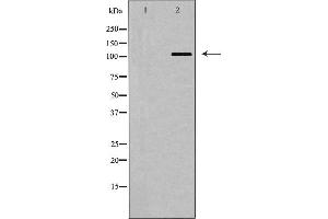 Western blot analysis of BUB1 expression in COLO205 cells,The lane on the left is treated with the antigen-specific peptide. (BUB1 抗体  (Internal Region))