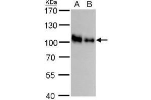 WB Image CD44 antibody detects CD44 protein by western blot analysis. (CD44 抗体)