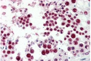 Human Testis (formalin-fixed, paraffin-embedded) stained with EZH2 antibody ABIN337251 at 5 ug/ml followed by biotinylated goat anti-rabbit IgG secondary antibody ABIN481713, alkaline phosphatase-streptavidin and chromogen. (EZH2 抗体  (Internal Region))