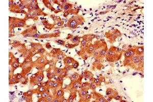 Immunohistochemistry of paraffin-embedded human liver tissue using ABIN7144713 at dilution of 1:100