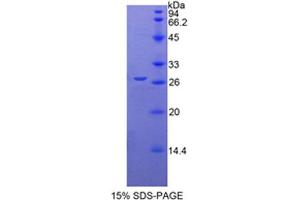 SDS-PAGE analysis of Mouse CYR61 Protein. (CYR61 蛋白)