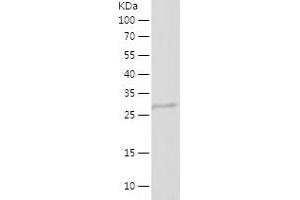 ANG Protein (AA 25-147) (His-IF2DI Tag)