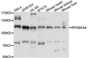 Western blot analysis of extracts of various cell lines, using RPS6KA4 antibody (ABIN6003828) at 1/1000 dilution. (MSK2 抗体)