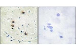 Immunohistochemistry analysis of paraffin-embedded human brain, using PKD1/PKC mu (Phospho-Ser205) Antibody. (PKC mu 抗体  (pSer205))