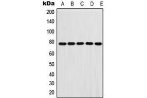 Western blot analysis of Fibulin 1 expression in A431 (A), A549 (B), HeLa (C), NIH3T3 (D), H9C2 (E) whole cell lysates. (Fibulin 1 抗体  (Center))