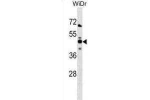 Western Blotting (WB) image for anti-N-Myc (And STAT) Interactor (NMI) antibody (ABIN3000888)