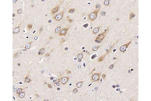 Immunohistochemistry analysis of paraffin-embedded Rat brain using DCX Polyclonal Antibody at dilution of 1:400. (Doublecortin 抗体)