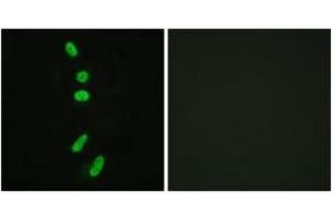 Immunofluorescence analysis of HeLa cells, using SF1 (Ab-82) Antibody. (Splicing Factor 1 抗体  (AA 48-97))