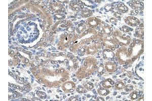 SLC12A1 antibody was used for immunohistochemistry at a concentration of 4-8 ug/ml to stain Epithelial cells of renal tubule (arrows) in Human Kidney. (SLC12A1 抗体)