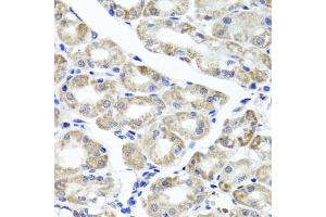 Immunohistochemistry of paraffin-embedded human stomach using MAPKBP1 antibody (ABIN5971432) at dilution of 1/100 (40x lens). (MAPKBP1 抗体)
