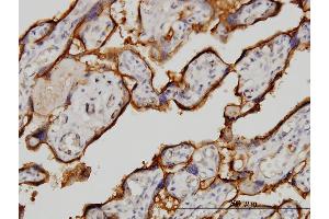 Immunoperoxidase of monoclonal antibody to TFRC on formalin-fixed paraffin-embedded human placenta. (Transferrin Receptor 抗体  (AA 68-168))