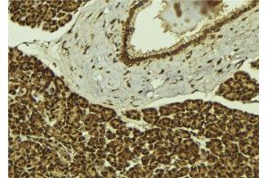 ABIN6279403 at 1/100 staining Mouse pancreas tissue by IHC-P. (UBR2 抗体  (C-Term))