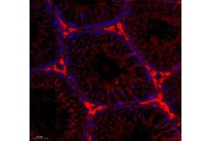 Immunofluorescence (Paraffin-embedded Sections) (IF (p)) image for anti-Vomeronasal 1 Receptor 2 (VN1R2) antibody (ABIN7076206)