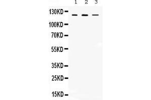 Western blot analysis of CIITA expression in rat thymus extract ( Lane 1), mouse thymus extract ( Lane 2) and MCF-7 whole cell lysates ( Lane 3). (CIITA 抗体  (AA 945-1130))