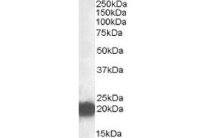 Image no. 1 for anti-Cysteine and Glycine-Rich Protein 3 (CSRP3) (Internal Region) antibody (ABIN375064) (CSRP3 抗体  (Internal Region))