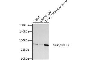 Immunoprecipitation analysis of 300 μg extracts of A-549 cells using 3 μg Kaiso/ZBTB33 antibody (ABIN7271437). (ZBTB33 抗体)