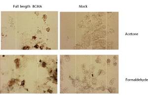 Immunostaining of HEK 293 cells transfected with a human BCMA expression plasmid (left panel), or mock transfected (right panel). (BCMA 抗体  (Extracellular Domain))