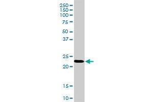RPL18 MaxPab rabbit polyclonal antibody. (RPL18 抗体  (AA 1-188))
