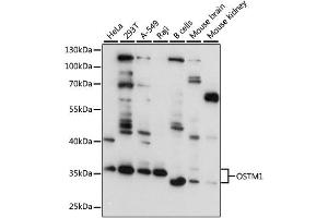 Western blot analysis of extracts of various cell lines, using OSTM1 antibody (ABIN4904622) at 1:3000 dilution. (OSTM1 抗体)