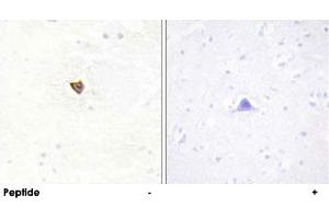 Immunohistochemistry analysis of paraffin-embedded human brain tissue using JAKMIP2 polyclonal antibody . (JAKMIP2 抗体  (C-Term))
