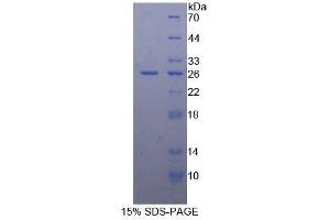 SDS-PAGE analysis of Mouse BCL2 Protein. (Bcl-2 蛋白)