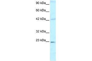 WB Suggested Anti-HMGB2 Antibody Titration:  0.