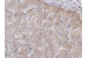 IHC-P analysis of Human Liver Tissue, with DAB staining. (PCYOX1 抗体  (AA 174-505))