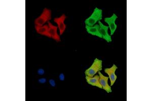 ABIN7096249 and ABIN7100311 staining Hela cells by IF/ICC.