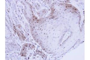 Immunohistochemistry (IHC) image for anti-Proteasome (Prosome, Macropain) Subunit, beta Type, 8 (Large Multifunctional Peptidase 7) (PSMB8) (Center) antibody (ABIN2856915)